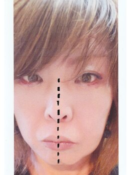 ガネェーシャ(Ganesha)/フェイスビート半顏施術