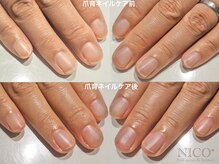 ニコプラス(NICO+)/爪育ネイルケア