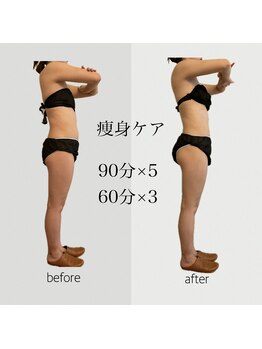 ファミーユ 名古屋店/【痩身ケア】ダイエット