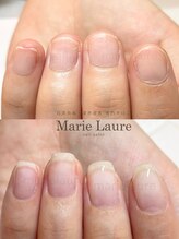 マリーロール 梅田店(Marie Laure)/深爪矯正/自爪育成/自爪風