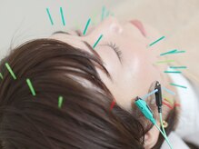 はり日和の雰囲気（<眼精疲労のツボにアプローチ>驚くほど視界がクリアに!目が開く!）