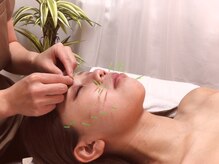 パル(PAL)の雰囲気（美容鍼はリフトアップも肌質改善もご要望に応じて対応します☆）
