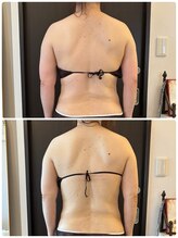 ルーシーガーデン(LUCY GARDEN)/6回目のお客様/40代