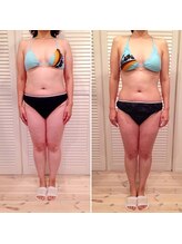 ビューティスペース バーディー(beauty space Birdy)/☆Before→After（前）☆