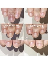 ニコプラス(NICO+)/爪育ネイルケア