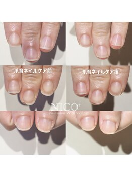 ニコプラス(NICO+)/爪育ネイルケア