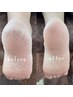 【フットケア】~フット角質ケア~かかとのガサガサ・ひび割れが気になる方に