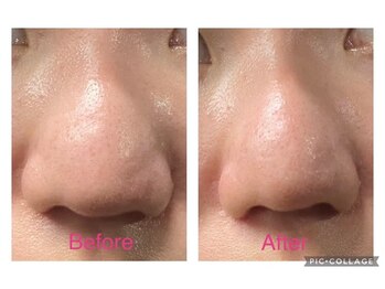 スリーズララ(Cerise LaLa)/