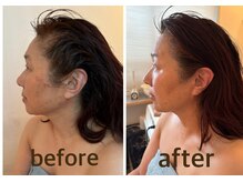 ロータスサリ/インディバフェイシャル／横顔