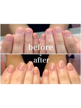 爪の悩みを解消できる（ケア含む）