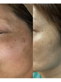 ブルーバケーション(Blue Vacation)/