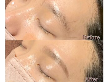 トリンテ バイ フェース(TRINTE by FAITH)/【ブロウマッピング】