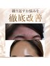 【ニキビ・肌荒れ】繰り返すお悩みを徹底改善│オーダーメイド90分 