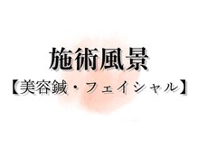 アキュレ(Acure)/美容鍼・フェイシャルコース