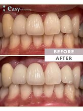 イージーホワイトニング 新宿店(easy whitening)/メンズ利用大歓迎！【新宿西口】