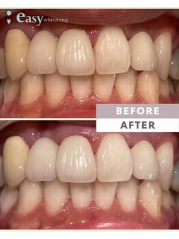イージーホワイトニング 新宿店(easy whitening)/メンズ利用大歓迎!【新宿西口】