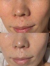 ウルソワン 都島店(/ulu soin)/くすみの改善