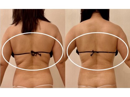 ワイグレイス(Y.GRACE)の写真