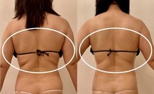 ワイグレイス(Y.GRACE)