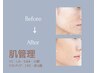 【メンズエステ】×【フェイシャル】シミ/シワ/たるみ/ニキビ￥5,800→