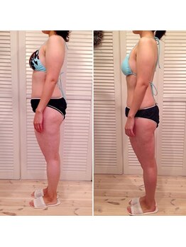 ビューティスペース バーディー(beauty space Birdy)/☆Before→After（横）☆