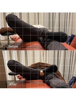 ナオル整体 宮崎院(NAORU整体)/20代女性施術事例【産後の歪み】