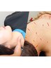【贅沢メニュー】美容鍼×全身美容整体　トータルメンテナンス♪