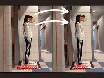 栄光治院 岡崎南院/岡崎/肩こり/産後/猫背/頭痛