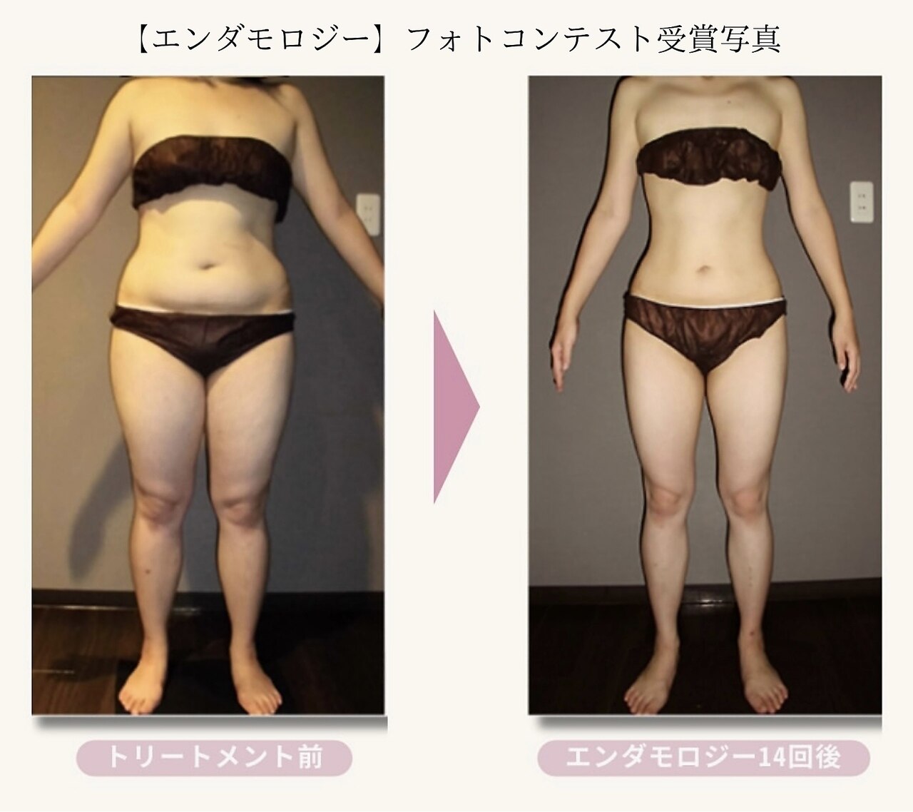 高田駅でエンダモロジーが人気のエステサロン｜ホットペッパービューティー