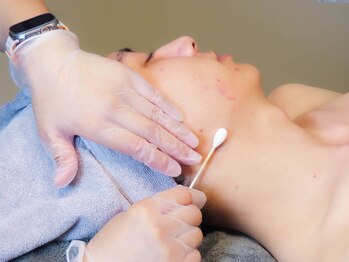 CDF 赤坂/剥かずに美肌！ララピーリング