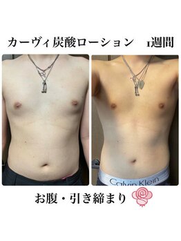 ケンビラク(Kenbiraku 健美楽)/お腹・引き締まり　1週間