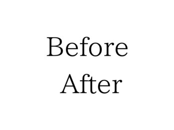 カルナ(CARNA)/施術Before →After 
