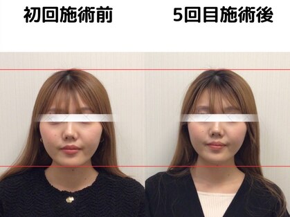 そよな はり灸整骨院の写真
