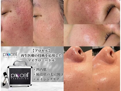 ミレット(Miretto)の写真