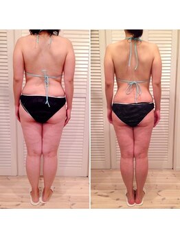 ビューティスペース バーディー(beauty space Birdy)/☆Before→After（後）☆