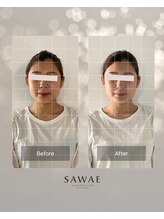 サワエギンザ(SAWAEGINZA)/before→after