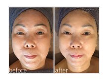 アン グレーヌ 自由が丘(unegraine)/頭皮からグッと引き上がります！