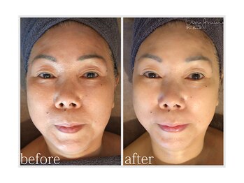 アン グレーヌ 自由が丘(unegraine)/頭皮からグッと引き上がります！