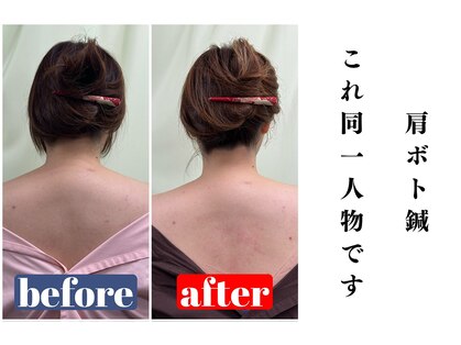 ボディーリメイカー鍼灸治療院(BODY REMAKER鍼灸治療院)の写真