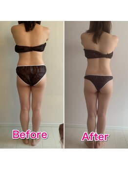 カーム整骨院/ダイエット整体ビフォーアフター