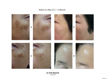 エムビューティークリニック(M beauty clinic)/肌質改善を本気でお考えの貴方へ