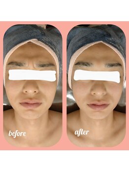 ウララン(URARAN)/メンズにも人気☆小顔コルギ