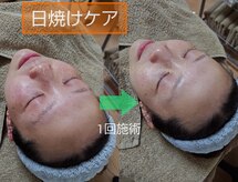 肌質改善サロン 姫路駅前店