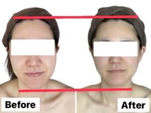 イオム ビューティワーク(IOM BEAUTY WORK)/顔の縦幅が短く！歪みも軽減◎