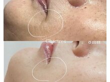 シャルトルズ 西宮北口店/