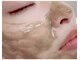 洗顔サロン 池袋(SENGAN)の写真/【剥離なしハーブピーリング】天然ハーブを贅沢配合し肌本来の力をサポート！ダウンタイムゼロ当日メイクOK