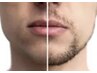 【★0円ではありません】　再来メンズ脱毛（ひげも部分もこちらから）