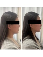 セルビューティー(Cell Beauty)/フェイスラインが別人級！