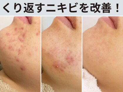 ハダイ(HADAY)の写真