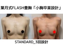 セブンシーズ 上野店(Seven Seas)/バストアップ/豊胸/東京都/上野